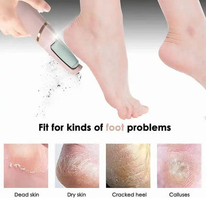 2-in-1 Foot File & Callus Remover