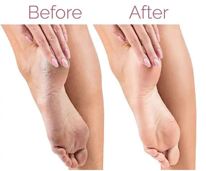 2-in-1 Foot File & Callus Remover